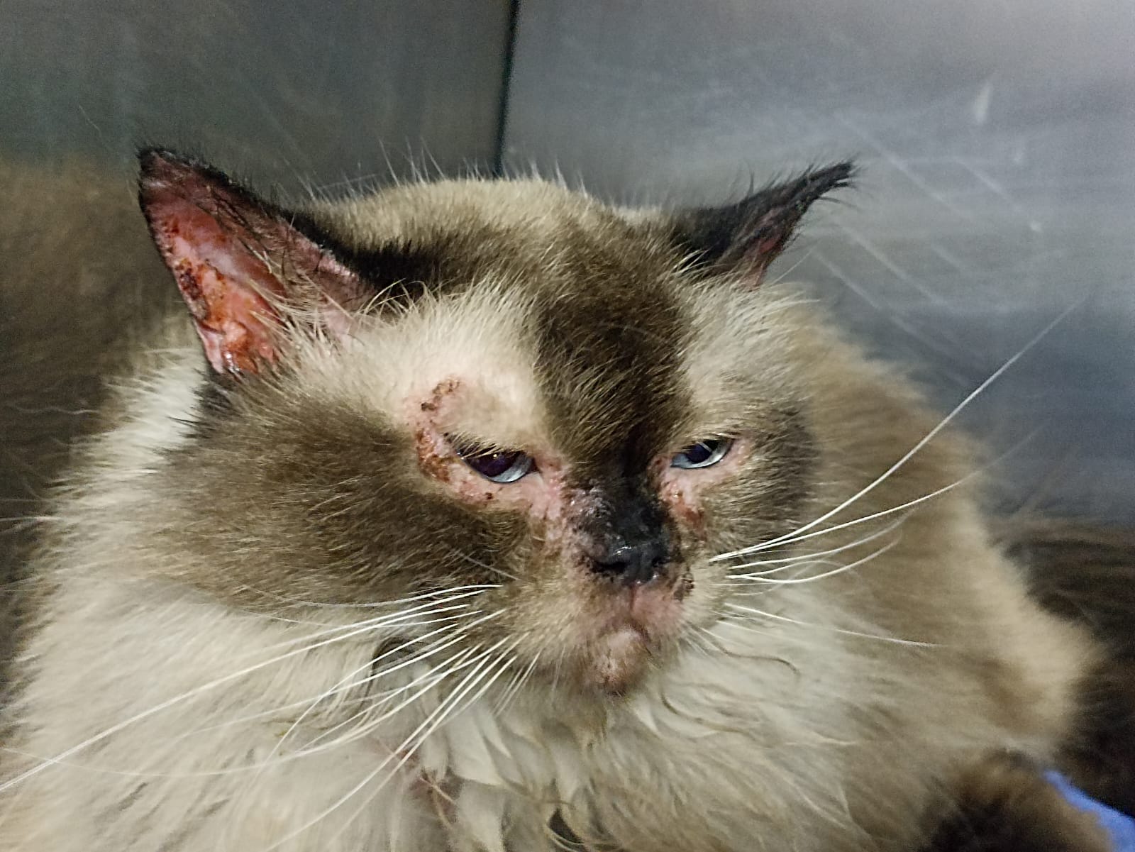 Hershe Before Treatment